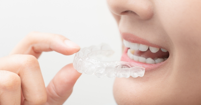 6. 美しい歯並びを手にいれる矯正治療