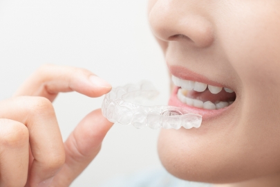 マウスピース矯正とは？