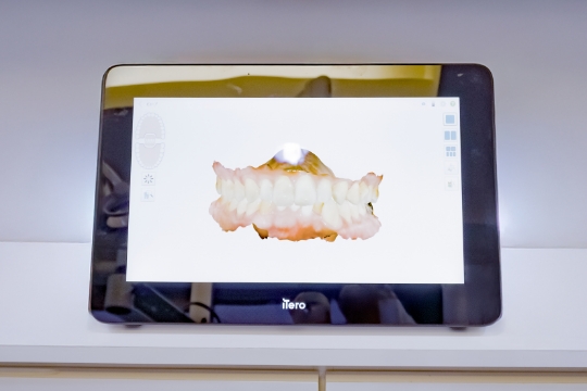 治療計画のご説明