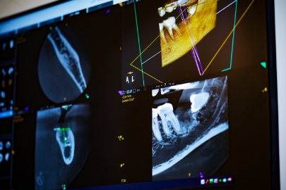 精密検査の実施