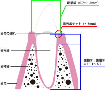 軽度歯周病の症状・診断